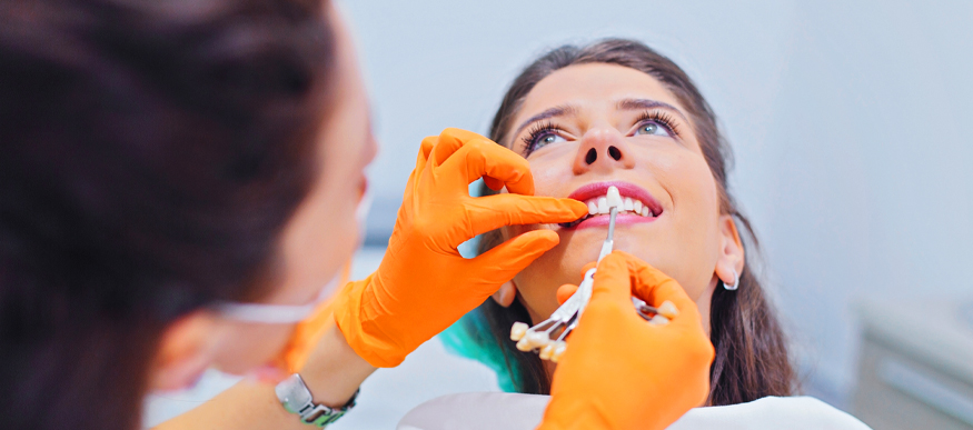 Zahnveneers: Ästhetik, Vorteile, Kosten und Nutzen
